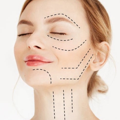 Rejuvenecimiento Orofacial, Dra. Gloria Vitriol